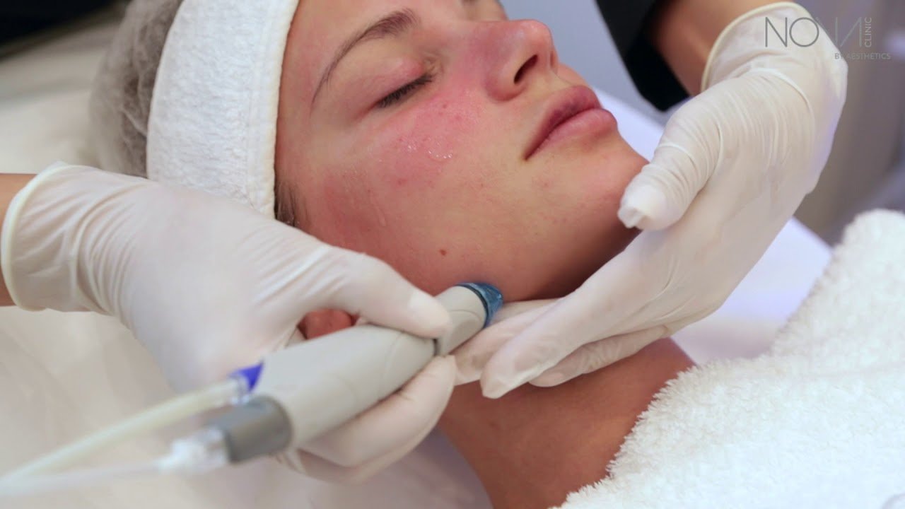 Where to Get the Best HydraCool Facial in Islamabad